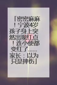 密密麻麻！宁波4岁孩子身上突然出现红点！连小便都变红了……家长：以为只是摔伤
